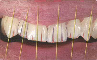 Пример естественной улыбки