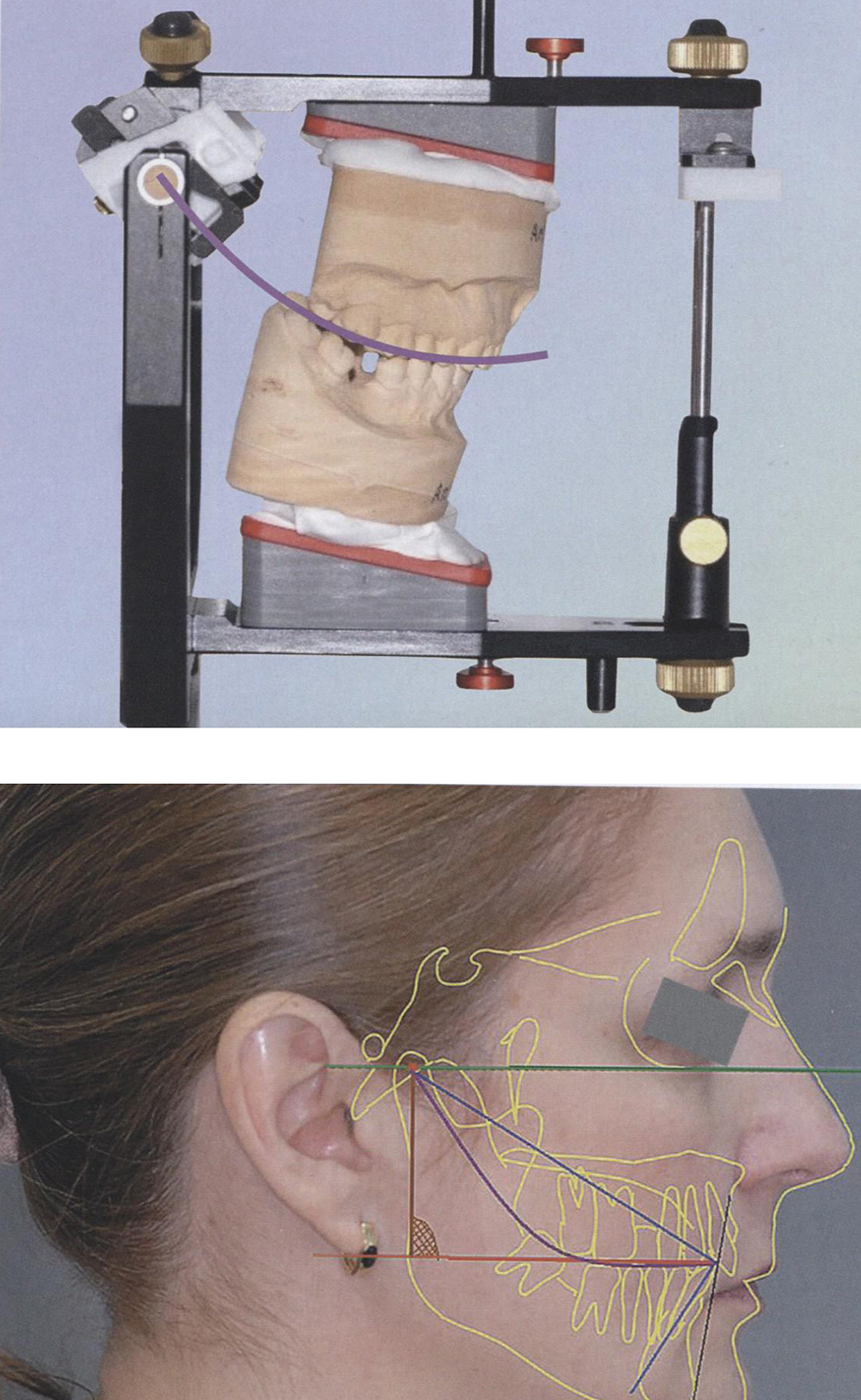 Компенсационная кривая Шпее
