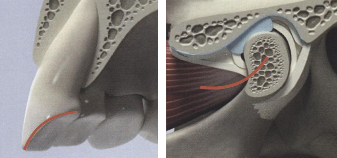  Соотношение сагиттального резцового (А) и сагиттального суставного (Б) путей