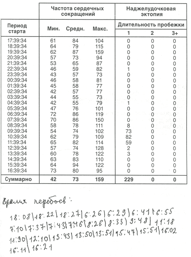 У пациента, 38 лет, с генерализованным тревожным расстройством время появления перебоев не совпадает