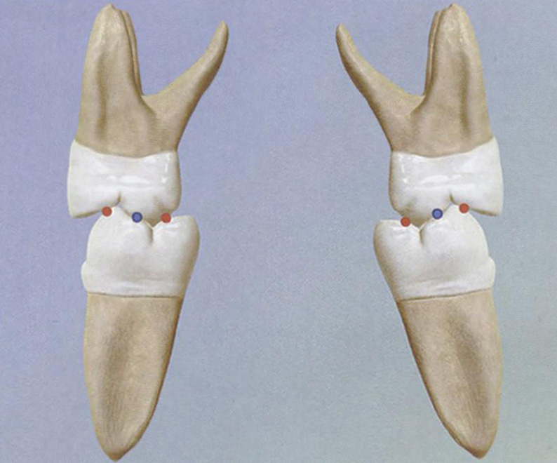 Характер смыкания боковых зубов в центральной окклюзии