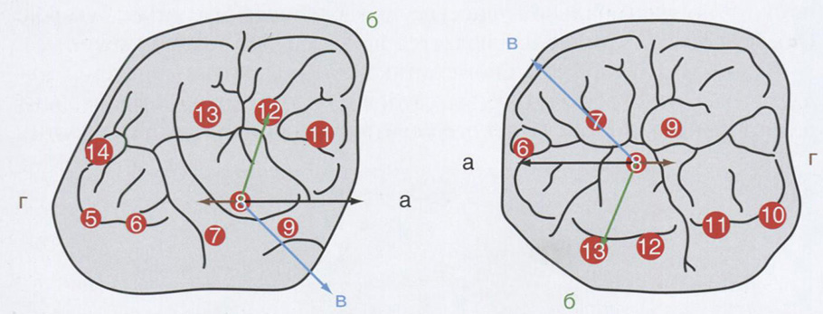 Окклюзионный компас на первом моляре 