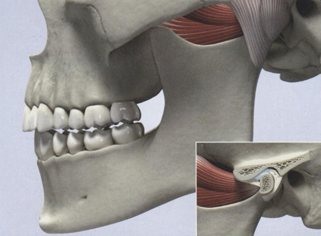 Одностороннее сокращение латеральной крыловидной мышцы слева