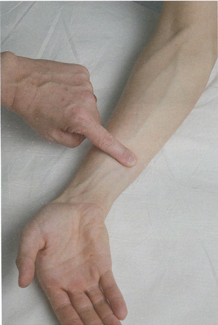 Рис. 3.89 Отведение кисти в локтевую сторону облегчает пальпацию локтевого сгибателя запястья (m. flexor carpi ulnaris)