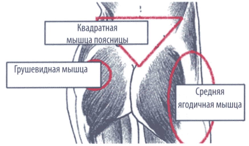Наиболее частые источники миофасциального синдрома (МФС) Наиболее частые источники миофасциального синдрома (МФС)