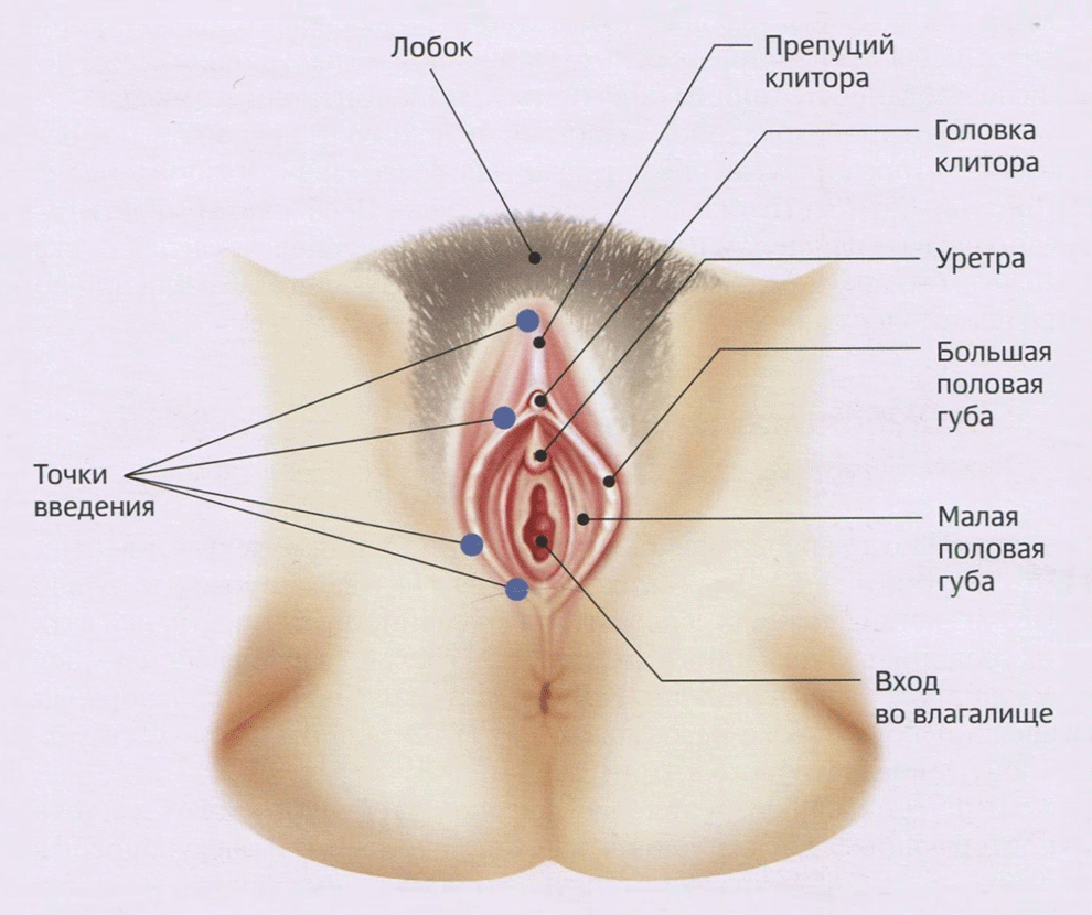 Рис. 5-1. Точки аугментации наружных половых органов.