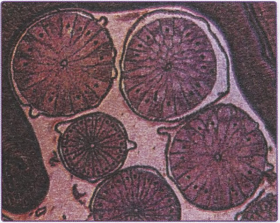 Поперечный срез Ascaris lumbricoides.