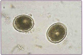 Яйцо Toxocara canis