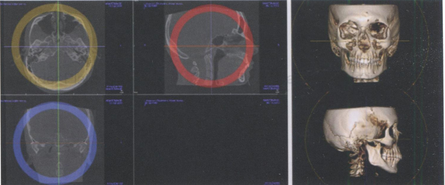 Позиционирование компьютерных томограмм в трех взаимно перпендикулярных плоскостях