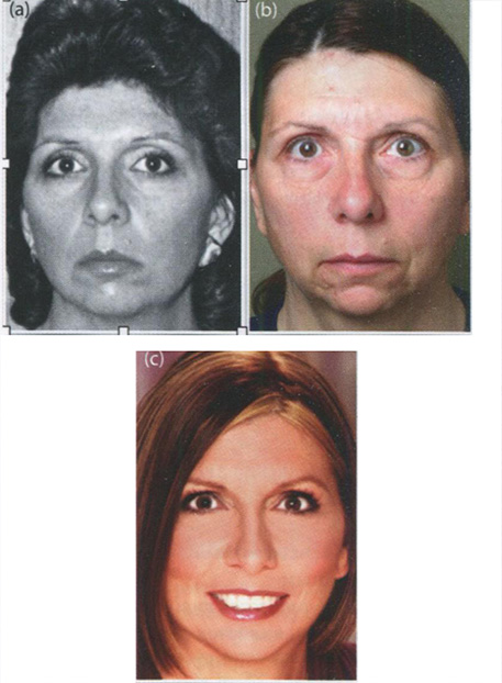 Создание красоты &mdash; создание молодости: пациентка в возрасте 20 лет