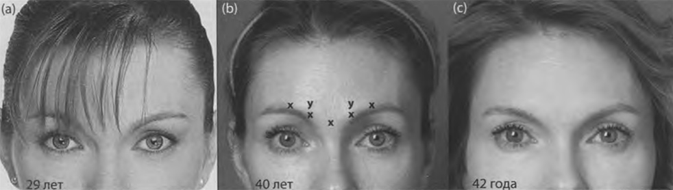 Привлекательное положение бровей в 29 лет