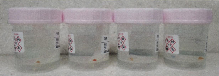 Контейнеры с образцами после полипэктомии. Все извлеченные образцы должны быть помещены в раздельные контейнеры