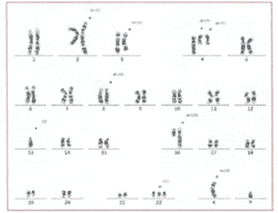 Рис. 154. Кариотип