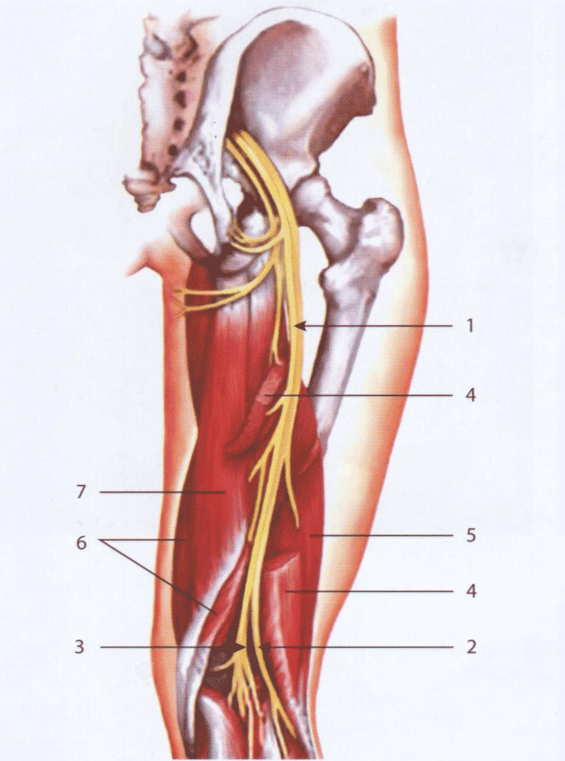 Схема анатомического расположения седалищного нерва в норме