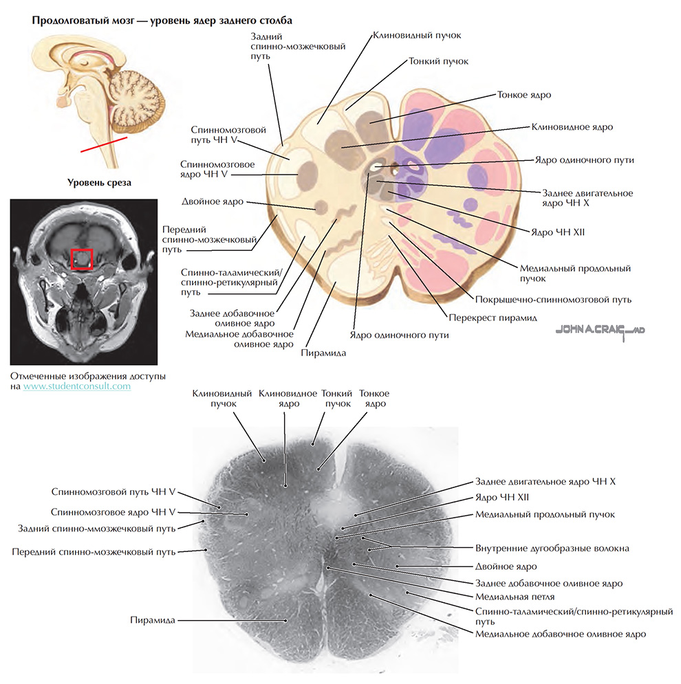 Поперечные срезы ствола мозга: срез 2