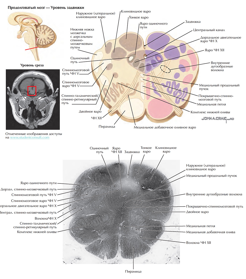 Поперечные срезы ствола мозга: срез 3