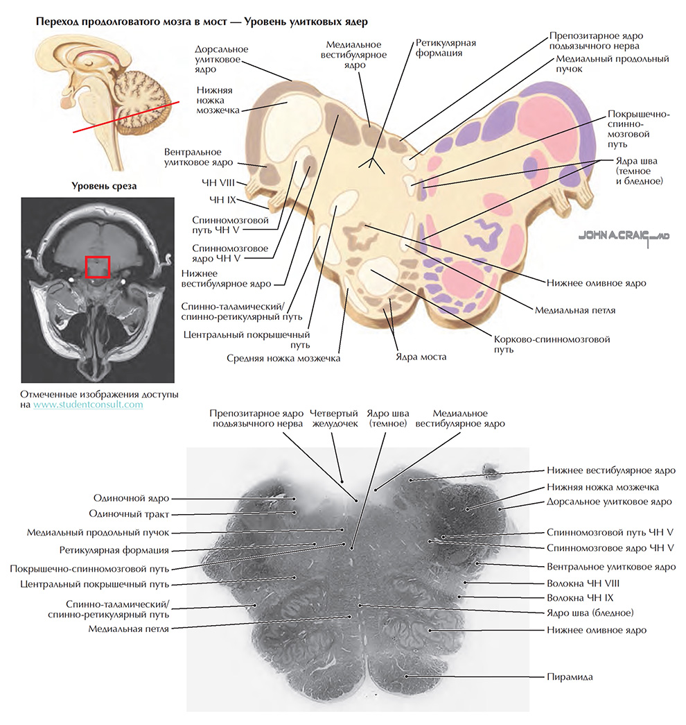 Переход продолговатого мозга в мост — Уровень улитковых ядер