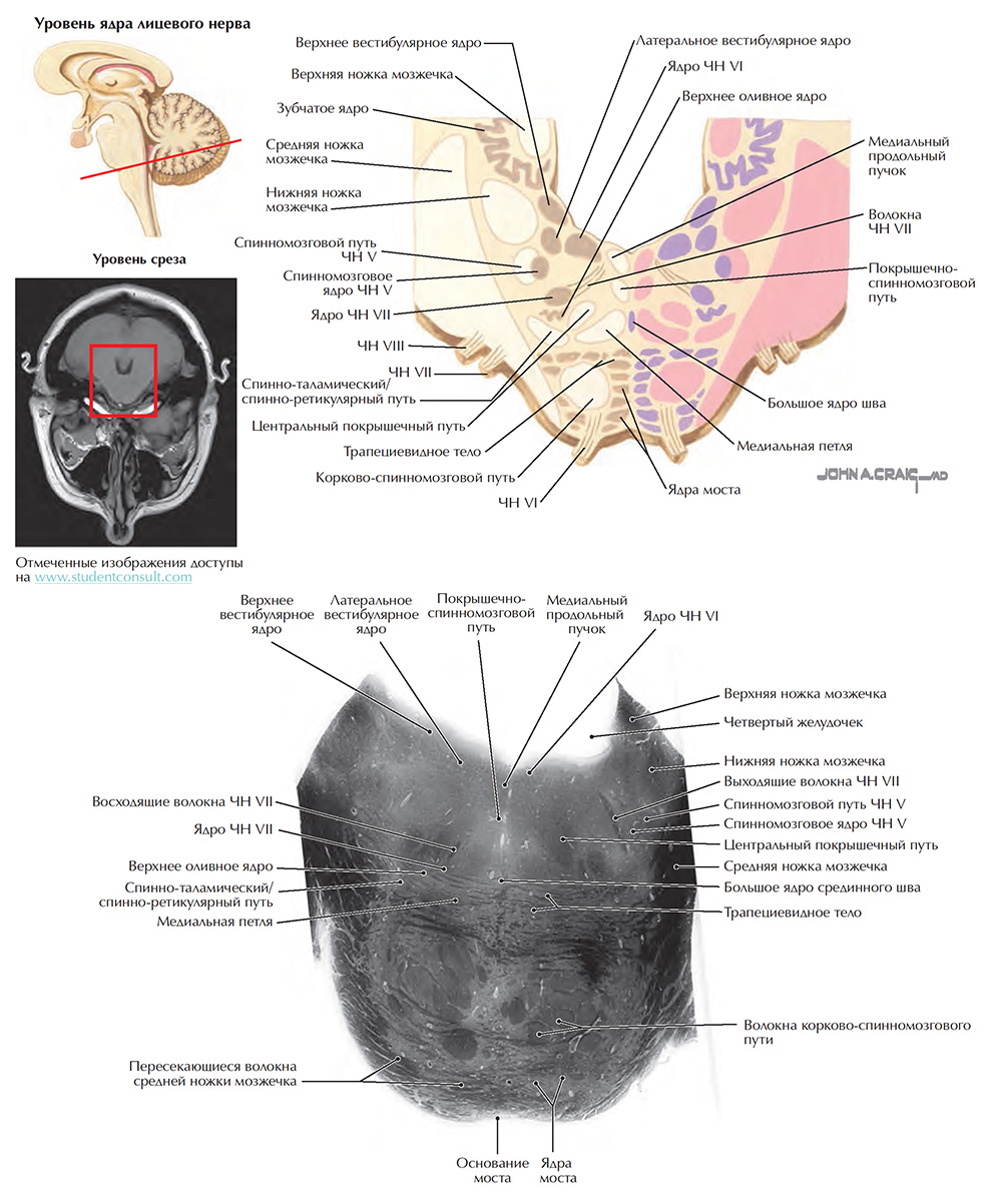 Поперечные срезы ствола мозга: срез 7. Уровень ядра лицевого нерва
