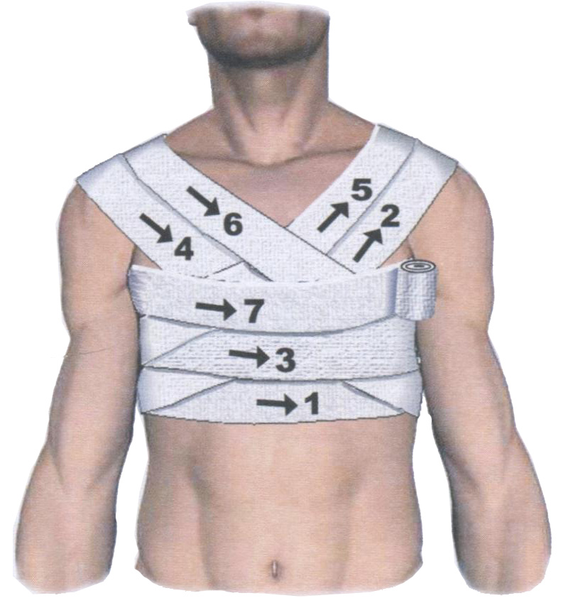Рис. 53. Крестообразная повязка на грудь