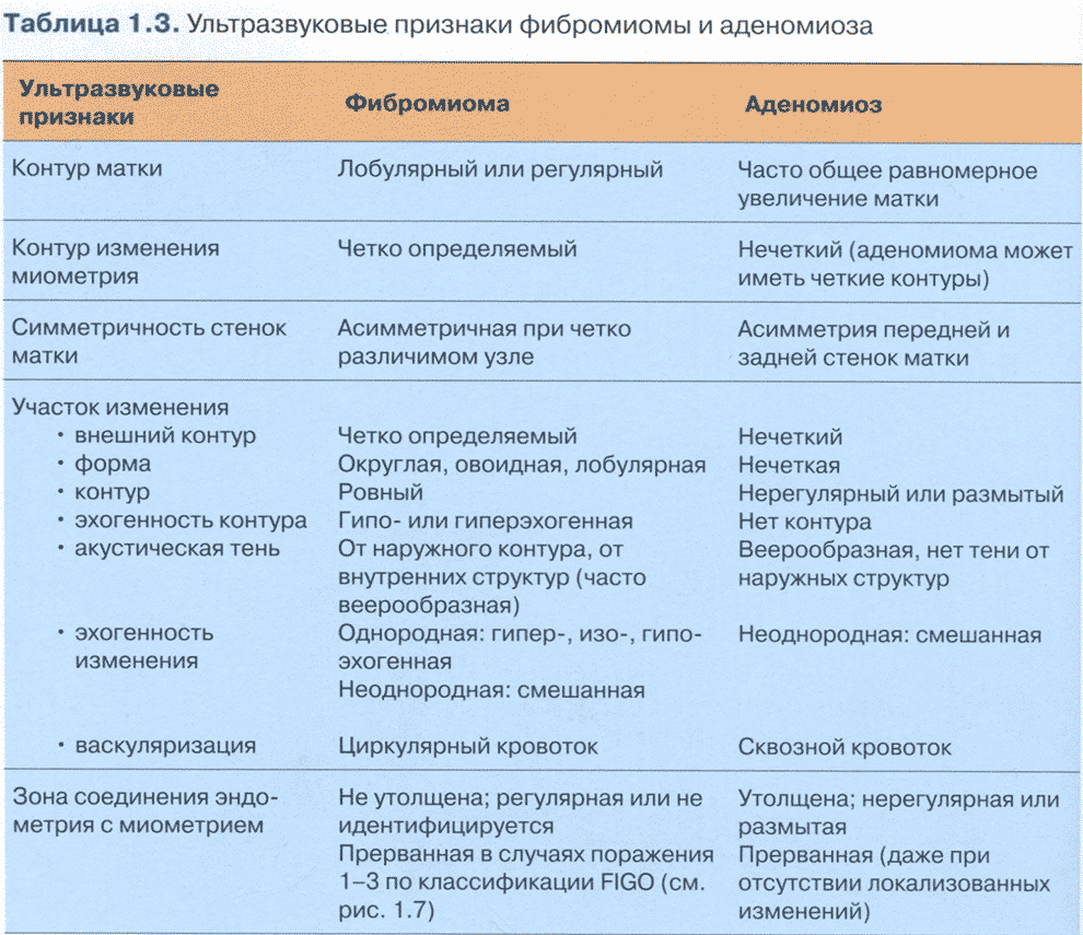 Таблица 1.3. Ультразвуковые признаки фибромиомы и аденомиоза