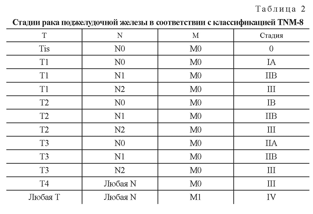 Стадии рака поджелудочной железы в соответствии с классификацией TNM-8 Стадии рака поджелудочной железы в соответствии с классификацией TNM-8