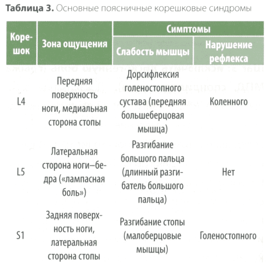 Таблица 3. Основные поясничные корешковые синдромы Таблица 3. Основные поясничные корешковые синдромы