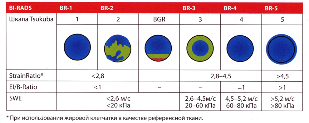 Таблица 4.3. Соответствие данных эластографии категориям по шкале BI-RADS (BR) в соответствии с реко­мендациями WFUMB