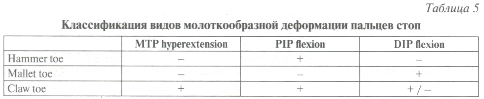 Таблица 5. Классификация видов молоткообразной деформации пальцев стоп