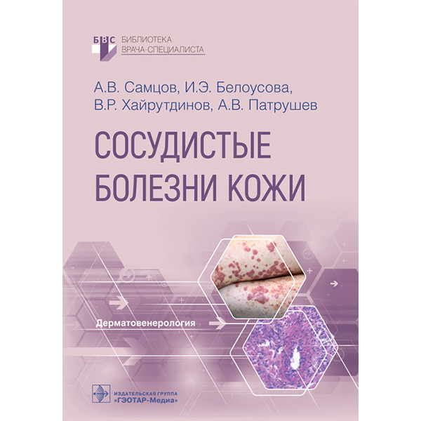 Купить книгу "Сосудистые болезни кожи" - Самцов А. В., Белоусова И. Э., Хайрутдинов В. Р., Патрушев А. В.