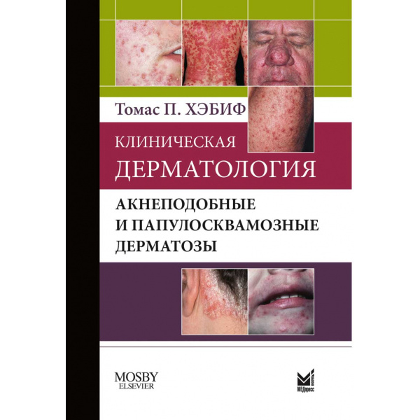 Купить книгу "Клиническая дерматология. Акнеподобные и папулосквамозные дерматозы - Хэбиф Т. П.