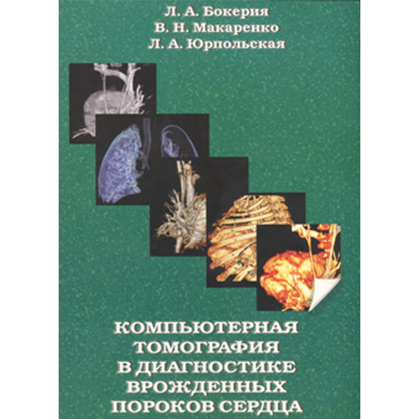 Купить книгу «Компьютерная томография в диагностике врожденных пороков сердца» &mdash; Бокерия Л. А., Макаренко В. Н., Юрпольская Л. А.