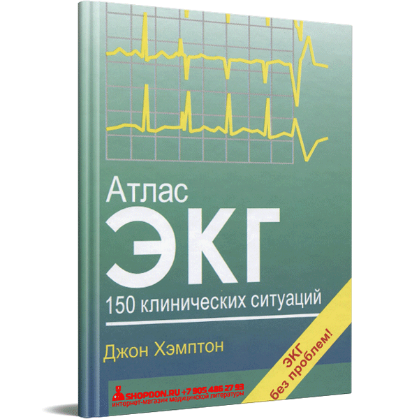 Купить книгу "Атлас ЭКГ. 150 клинических ситуаций" - Хэмптон Дж.