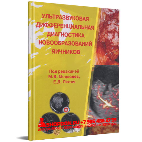 Купить книгу "Ультразвуковая дифференциальная диагностика новообразований яичников. Методические рекомендации - М. В. Медведев