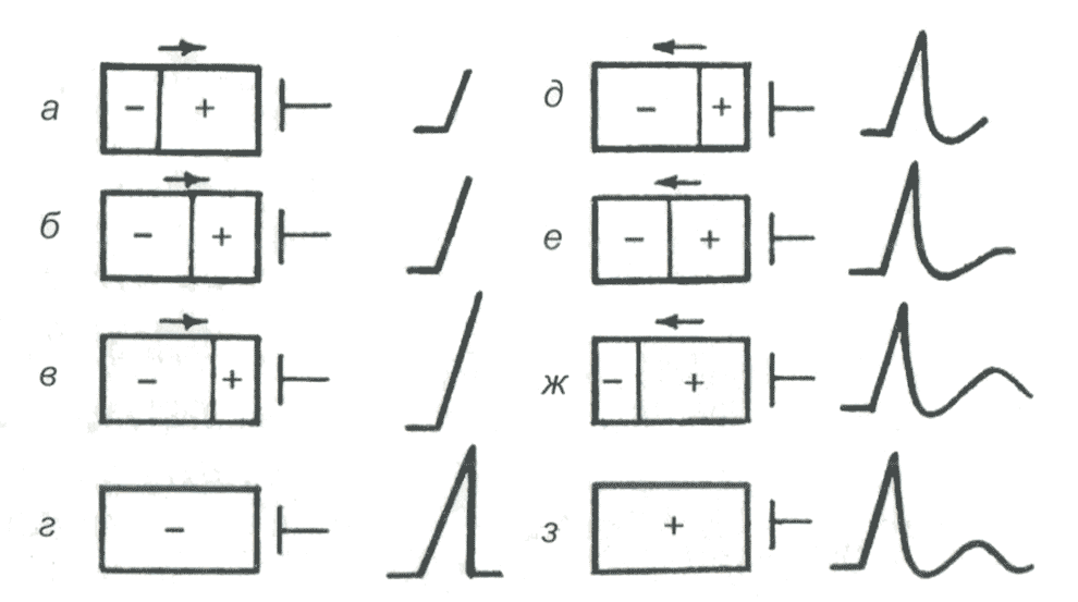 Распространение волны возбуждения