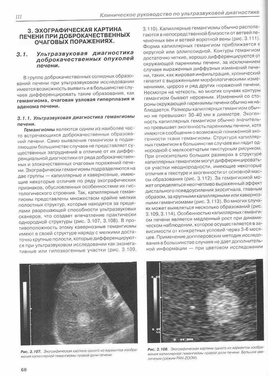 Эхографическая картина печени при доброкачественных очаговых поражениях