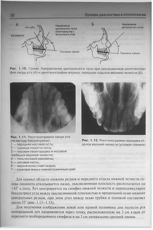 Рентгеннограма свода рта Рентгеннограма свода рта