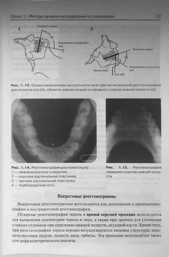 Рентгенография дна полости рта Рентгенография дна полости рта