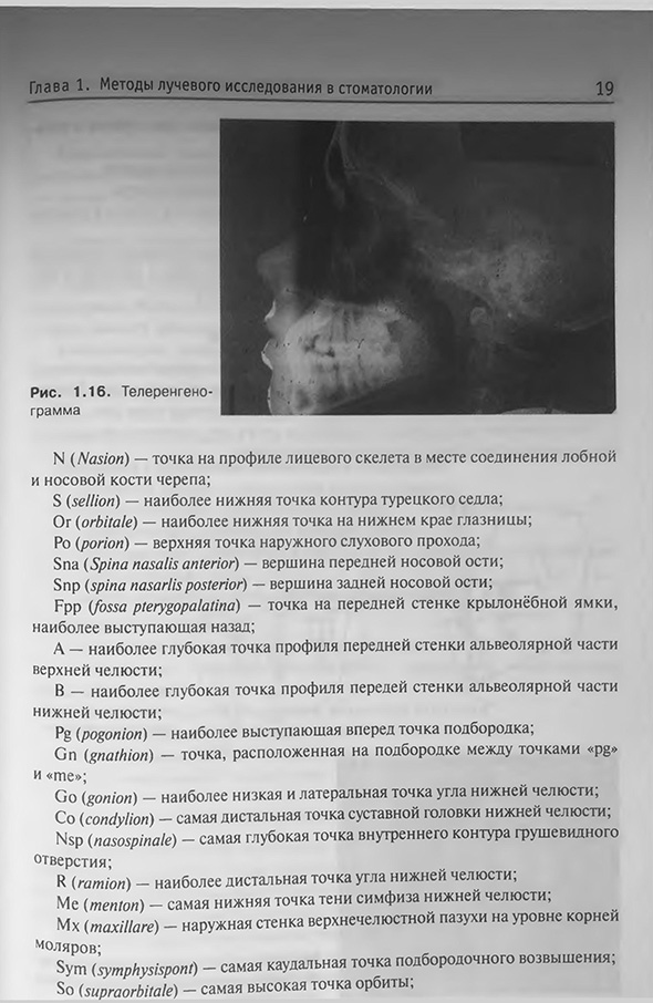 Телерентгенограмма Телерентгенограмма