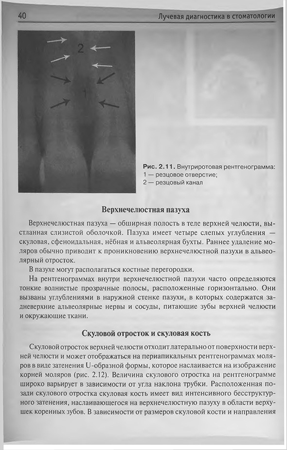 Внутриротовая рентгенограмма Внутриротовая рентгенограмма