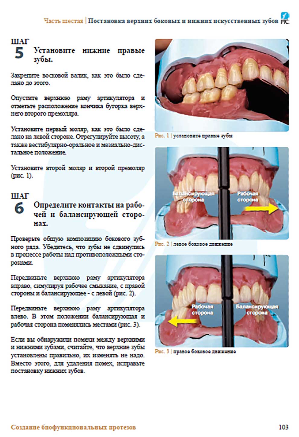 Постановка верхних боковых и нижних искусственных зубов