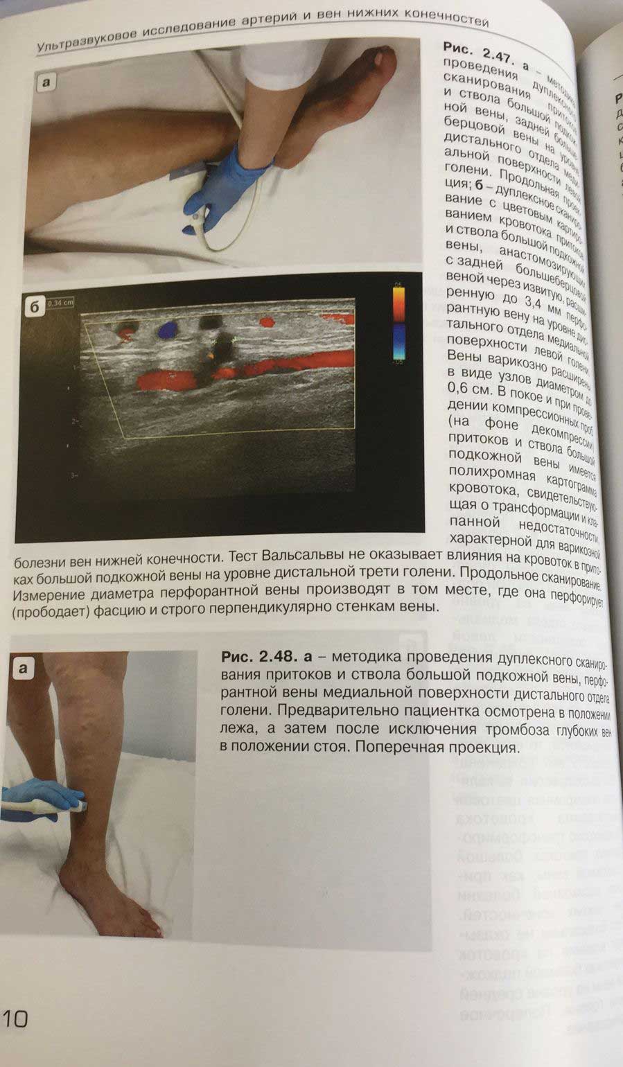 Пример страницы из книги "Ультразвуковое исследование при заболеваниях артерий и вен нижних конечностей"