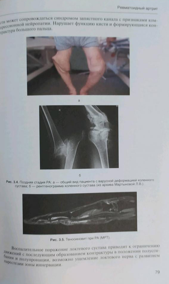 Пример страницы из книги "Клиническая ревматология. Руководство для врачей" - В. И. Мазуров