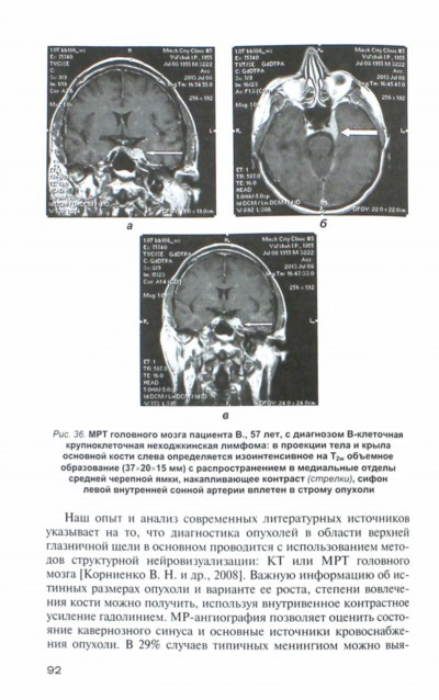 МРТ головного мозга пациента