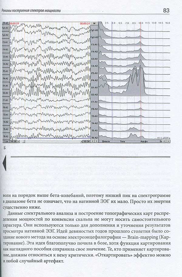 Примеры станиц из книги "Неэпилептическая электроэнцефалография"