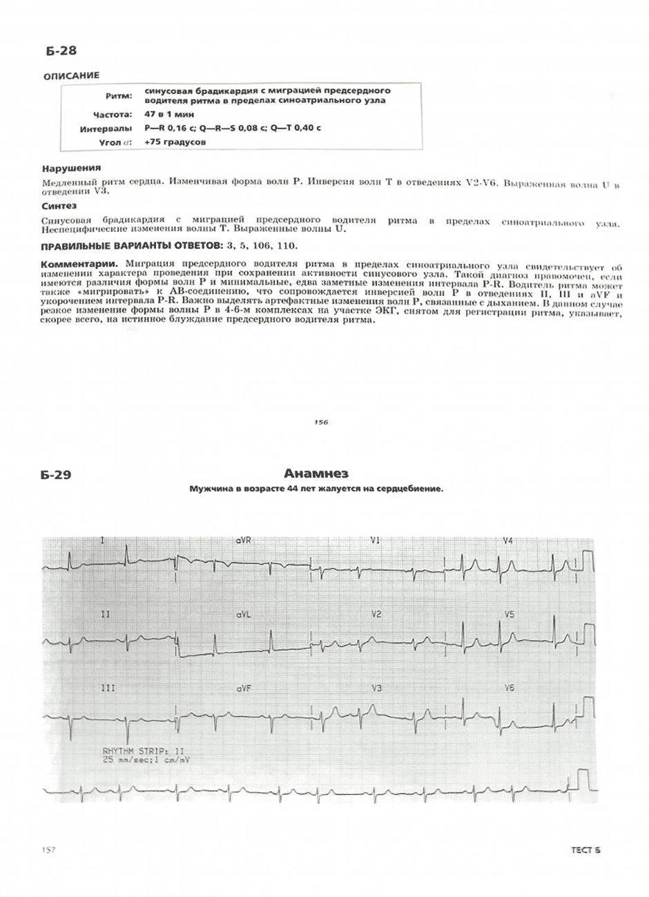 Пример страницы из книги "Клиническая электрокардиография" - Циммерман Франклин