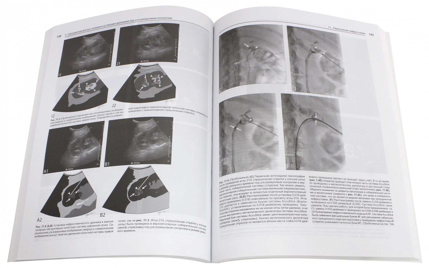 Пример страницы из книги "Интервенционные процедуры под ультразвуковым контролем" - Догра Викрэм, Монзер Абу-Юсеф, Браун Даниэль