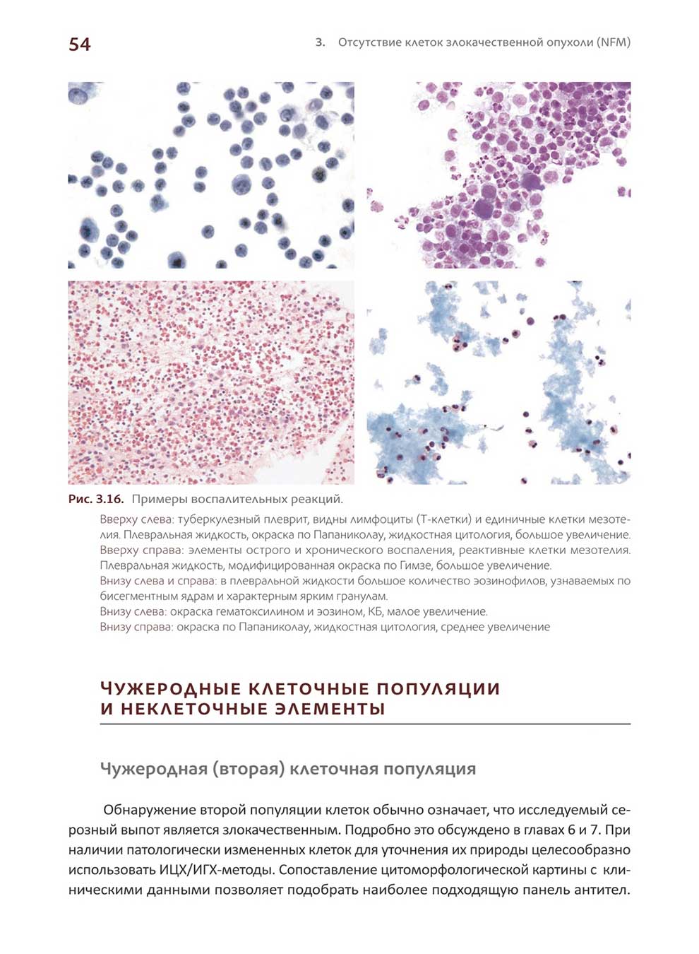 Примеры воспалительных реакций.