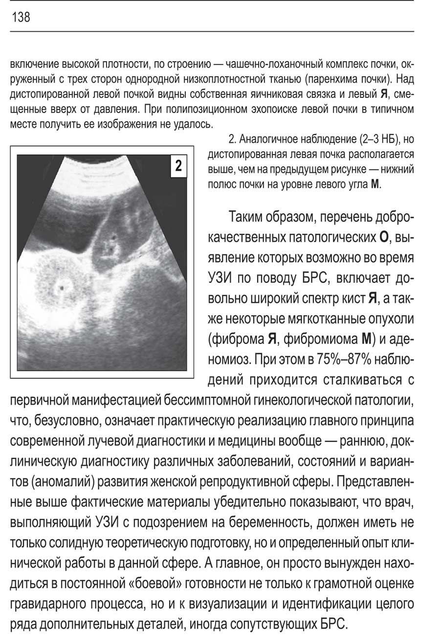 Пример страницы из книги "Ультразвуковое исследование при беременности раннего срока"