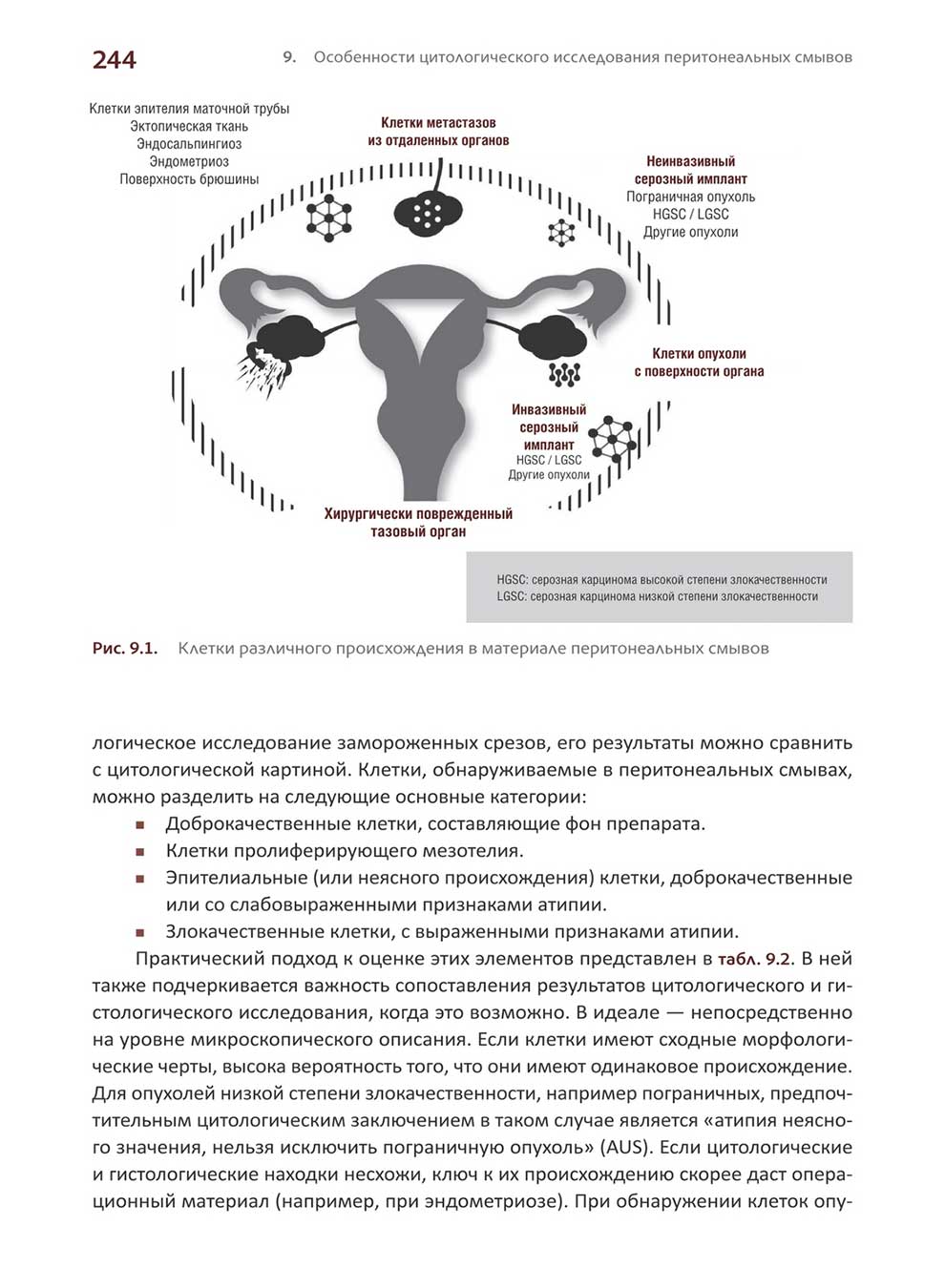 Клетки различного происхождения в материале перитонеальных смывов