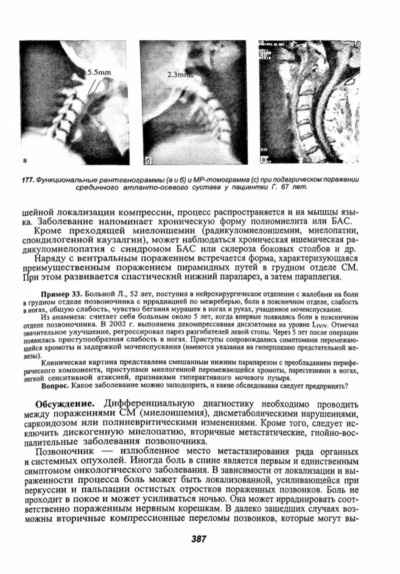 Содержание книги "Спинной мозг: (клинические и патофизиологические сопоставления)" - Вишневский А. А.